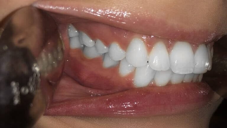 Smile Image