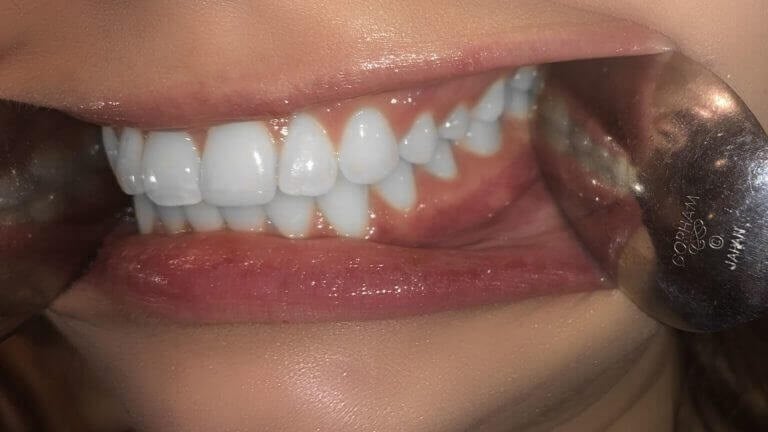 Smile Image