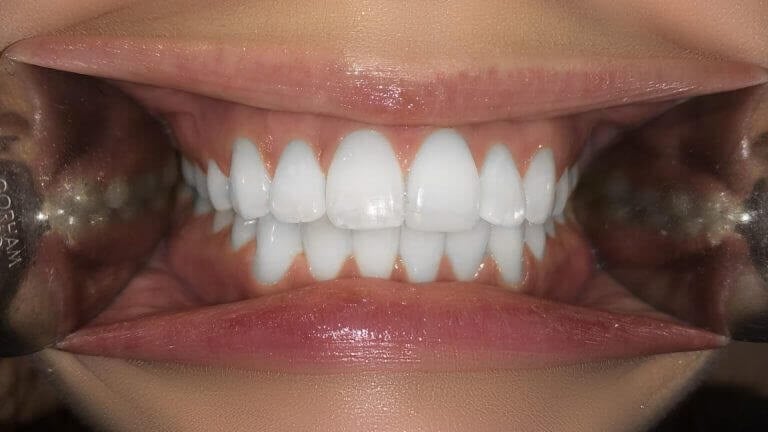 Smile Image